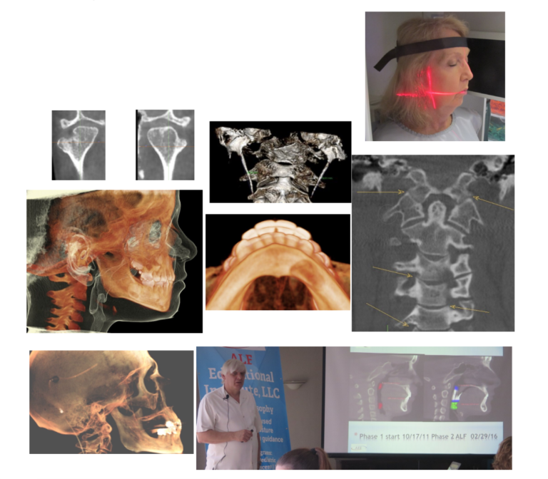 Course 9 CBCT Interpretation and Evaluation The ALF Educational